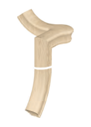 Handrail Fitting Left Hand 2-Rise Quarter Turn Gooseneck with Cap 60-2