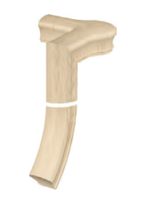 Handrail Fitting Left Hand 2-Rise Quarter Turn Gooseneck with Cap 81-2
